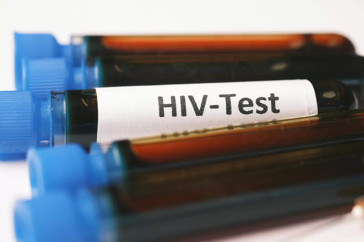 Blood vials labeled "HIV-Test"